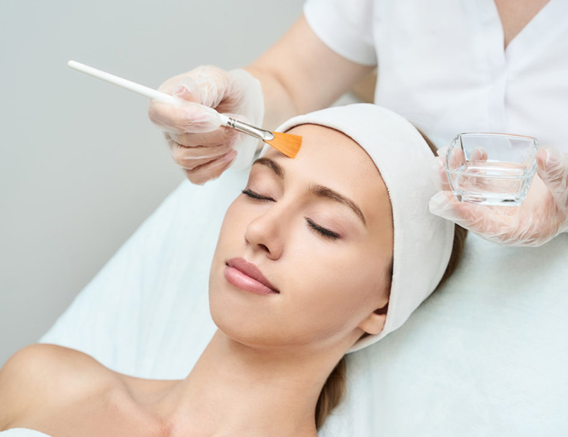 Femme recevant un peeling chimique en cabinet dermatologique, avec application de la solution sur le visage.