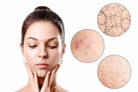 Parlons du soin de la peau:Il est essentiel de comprendre les besoins de votre peau pour des soins efficaces. En connaissant votre type de peau, en utilisant les produits appropriés et en suivant une routine de soins adaptée, vous pouvez obtenir une peau saine, éclatante et bien entretenue.
