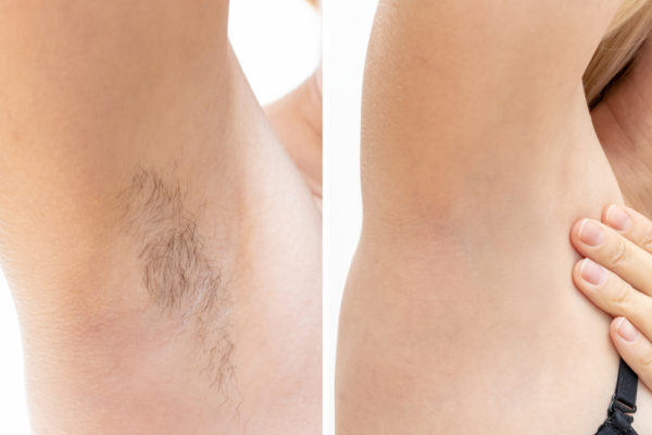 Parlons du soin de la peau:L'image présente des conseils pratiques pour prendre soin de la peau après l'épilation. Parmi ces conseils, on retrouve l'application d'une crème hydratante apaisante, l'utilisation de produits non irritants, le port de vêtements amples pour éviter les frottements et l'exfoliation douce pour prévenir les poils incarnés. Ces conseils permettent de maintenir une peau douce, lisse et bien entretenue après l'épilation.